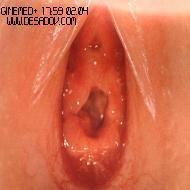Частная гинекология - Марк Десадов